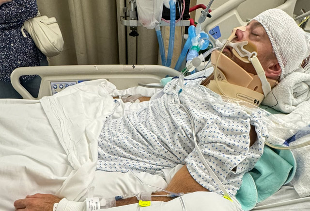 Nurse attacked while working at South Beach Psychiatric Center shares his story