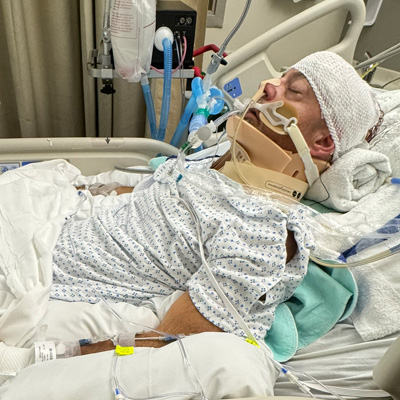 Nurse attacked while working at South Beach Psychiatric Center shares his story